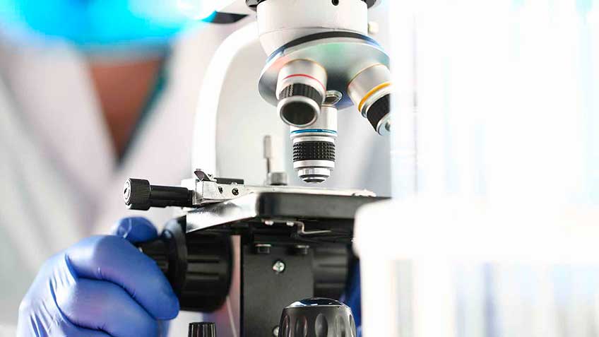 excitotoxinas-cerebro-y-excitotoxicidad HitLive | Mañanas Poderosas