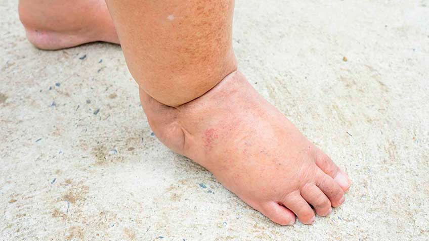 inflamacion-y-resistencia-a-la-insulina-conclusiones HitLive | Mañanas Poderosas