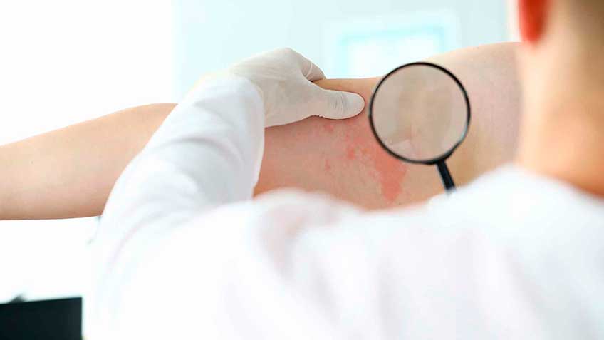 la-disbiosis-contribuciones HitLive | Mañanas Poderosas