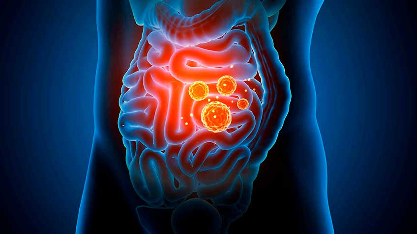 la-disbiosis-introduccion HitLive | Mañanas Poderosas