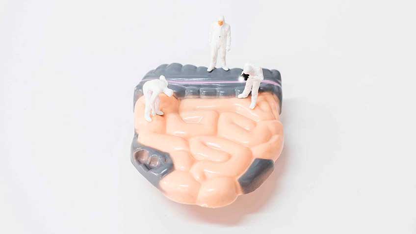 si-ntomas-por-toxinas-circulantes-intestinales image si-ntomas-por-toxinas-circulantes-intestinales Blog - HitLive