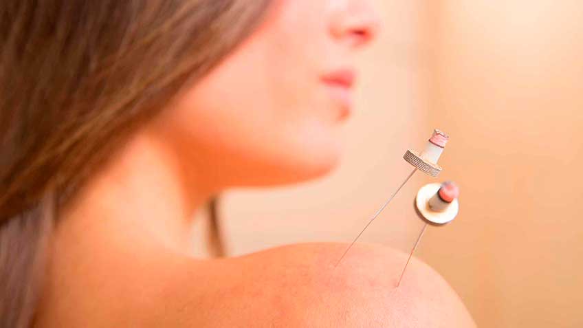 terapeuticas-en-mtc-medicina-china-acupuntura-estudios-clinicos HitLive | Mañanas Poderosas