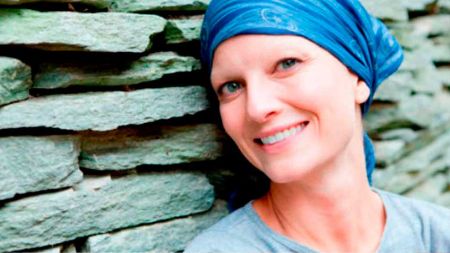 ebf9659c17f99ab839a48802ceb3d083 Conoce qué son los hilos de colágeno - HitLive